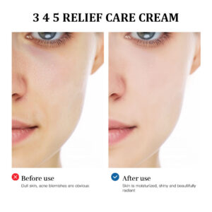 Alternative view of 345 Relief Cream Face Moisturizer Cream Nourish Soothing Skin Repair Clean Acne for Oily Skin, Hydrating Facial Lotion Skincare