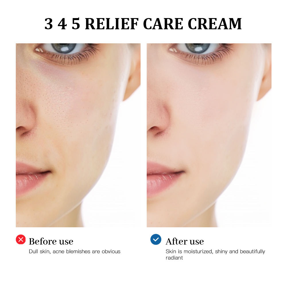 345 Relief Cream Face Moisturizer Cream Nourish Soothing Skin Repair Clean Acne for Oily Skin, Hydrating Facial Lotion Skincare - Image 2