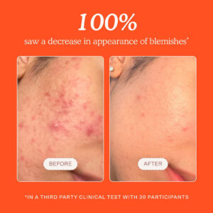 Alternative view of Oem Private Label Hypochlorous Acid Spray Reduce Redness Soothing Hydrating Calming Liquid Skin Care Products Face Toner Mist